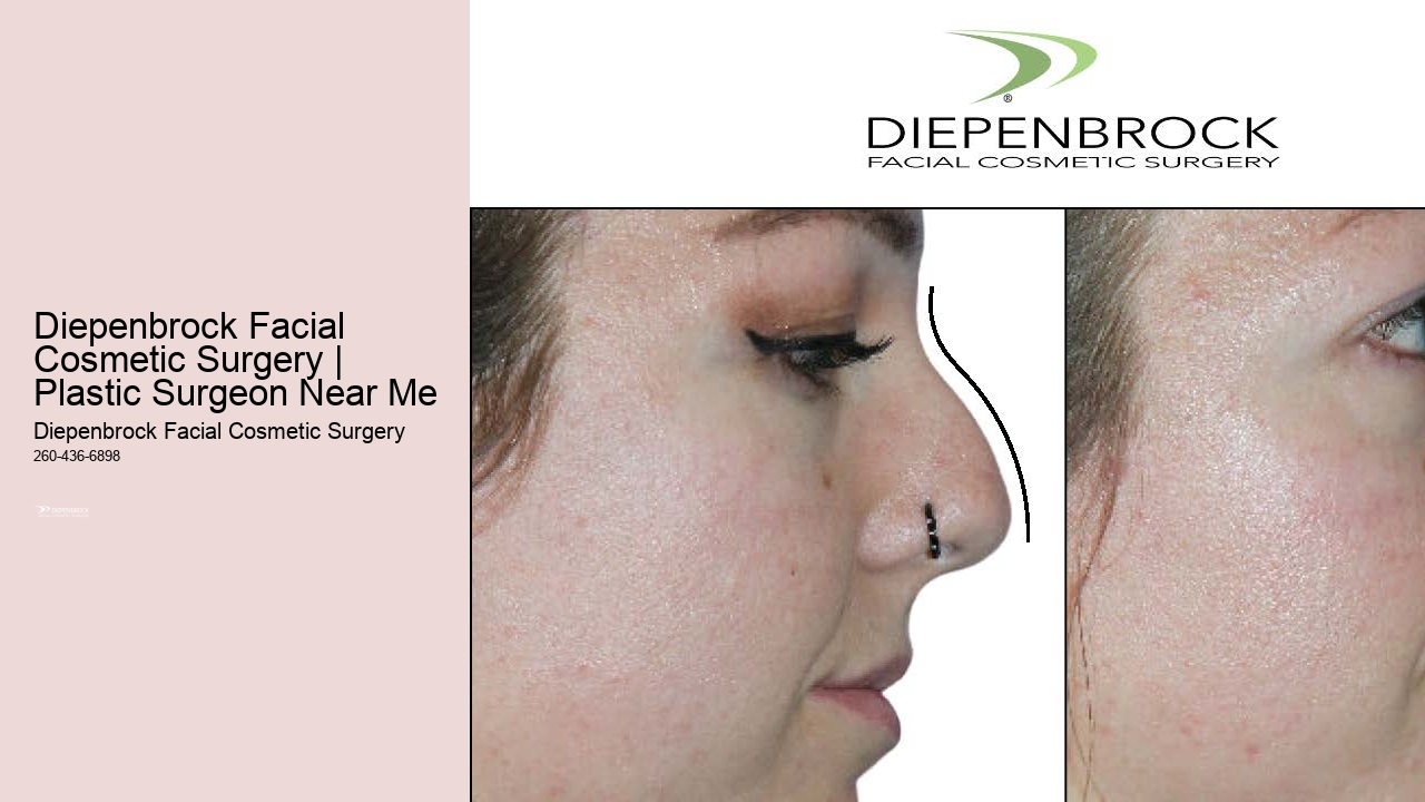 Diepenbrock Facial Cosmetic Surgery | Plastic Surgeon Near Me