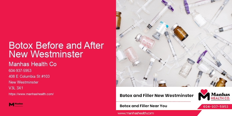 Cosmetic Dermatology Clinic Botox Before and After New Westminster