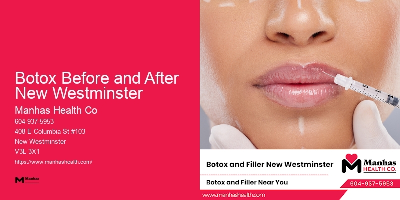 Bespoke Botox and Injectable Fillers Botox Before and After New Westminster
