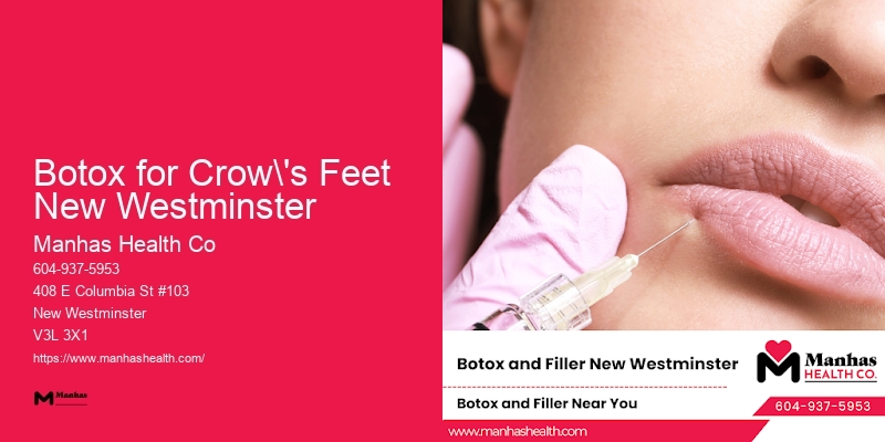 Beauty Injection Center Botox for Crow's Feet New Westminster