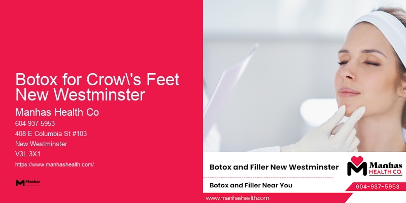 Botox for Crow's Feet New Westminster