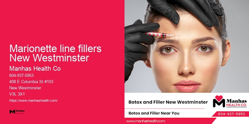 Marionette line fillers New Westminster