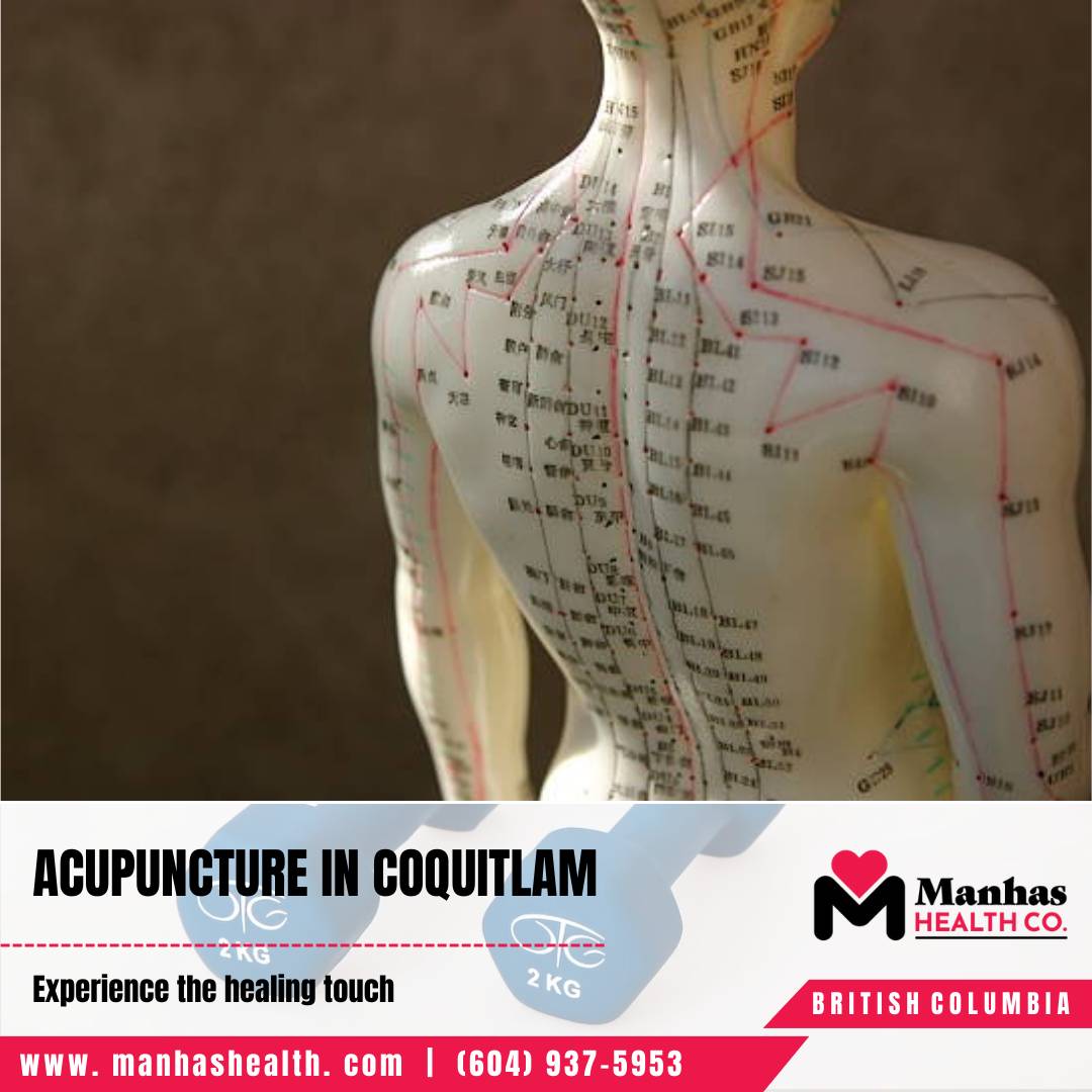 Best Physiotherapy Clinic Physiotherapy Expert Coquitlam