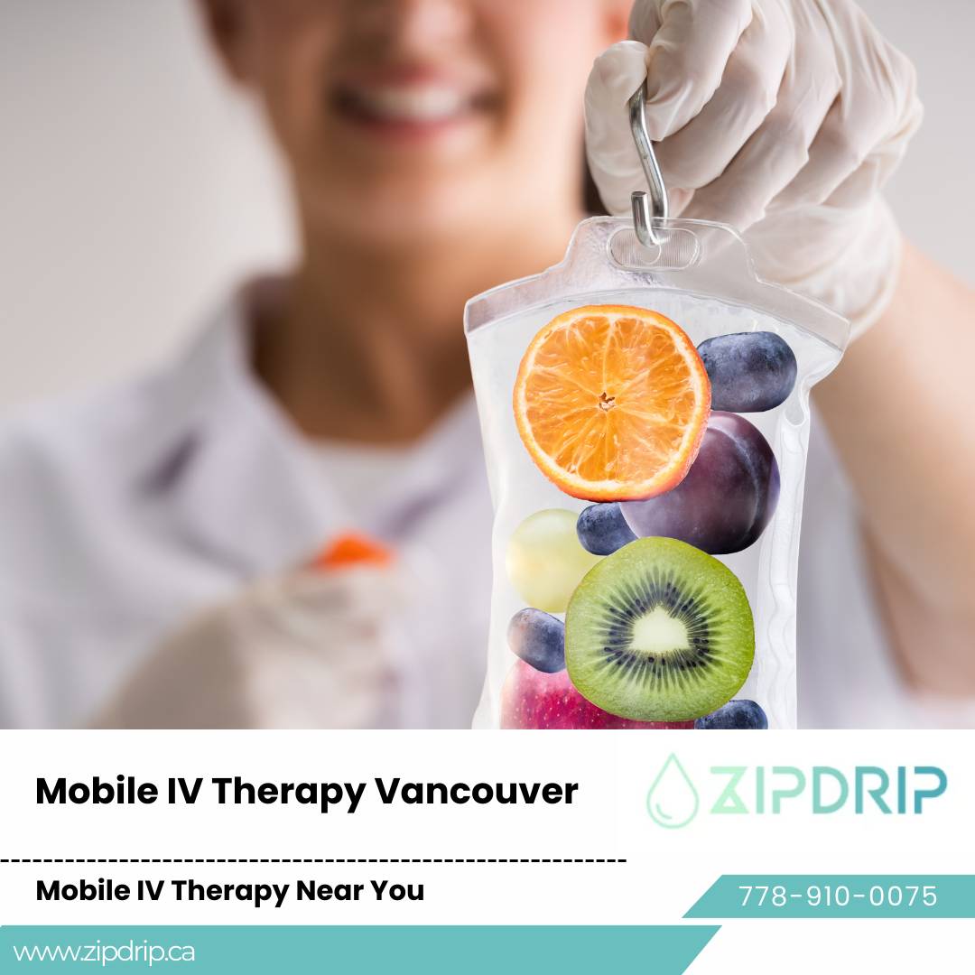Mobile IV Therapy for Stress Vancouver Mobile IV Treatment