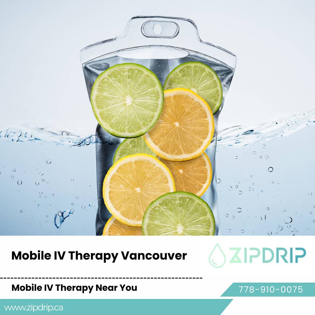 Home visit IV infusion Mobile Wellness Drip Vancouver
