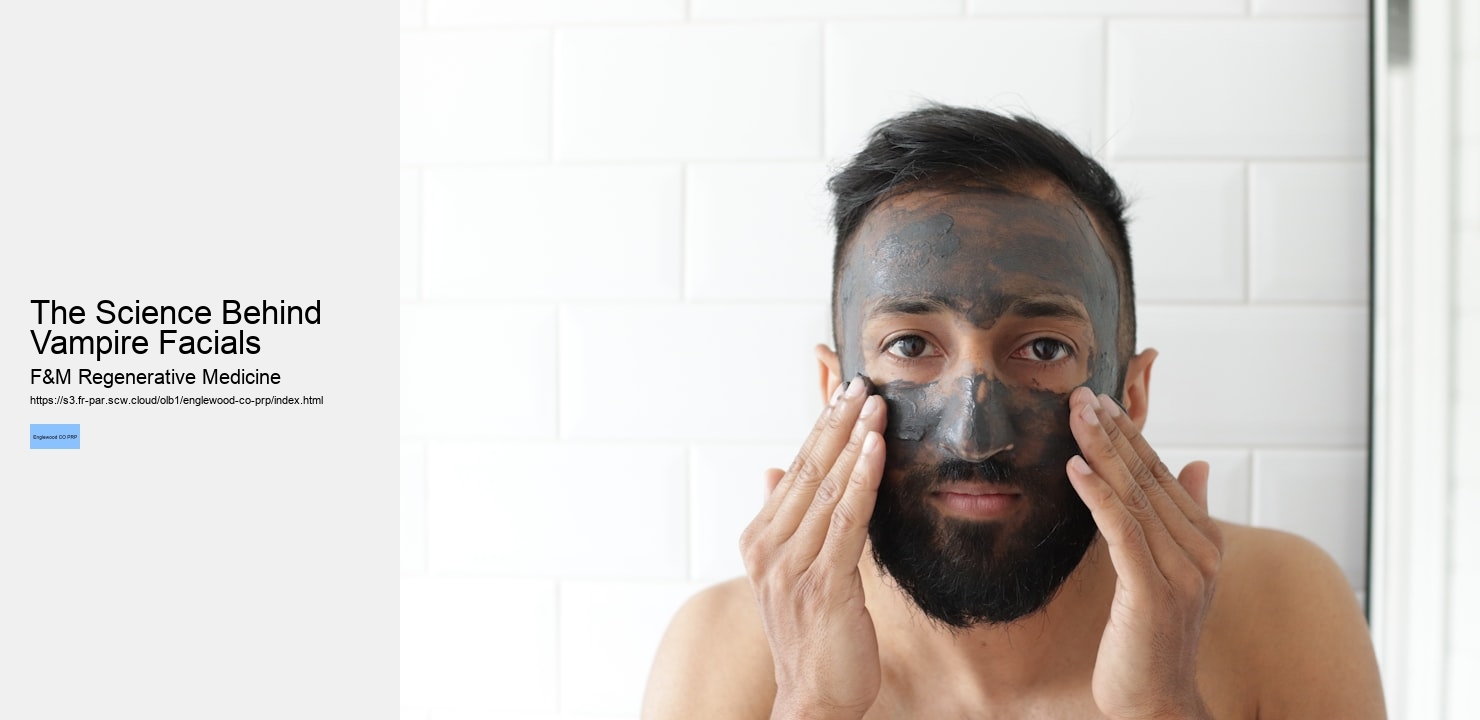The Science Behind Vampire Facials