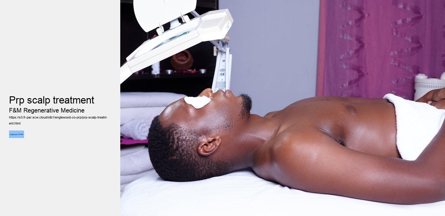 prp scalp treatment