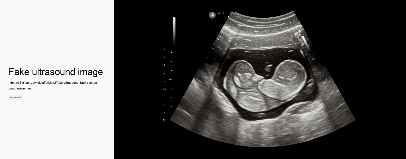 fake ultrasound image