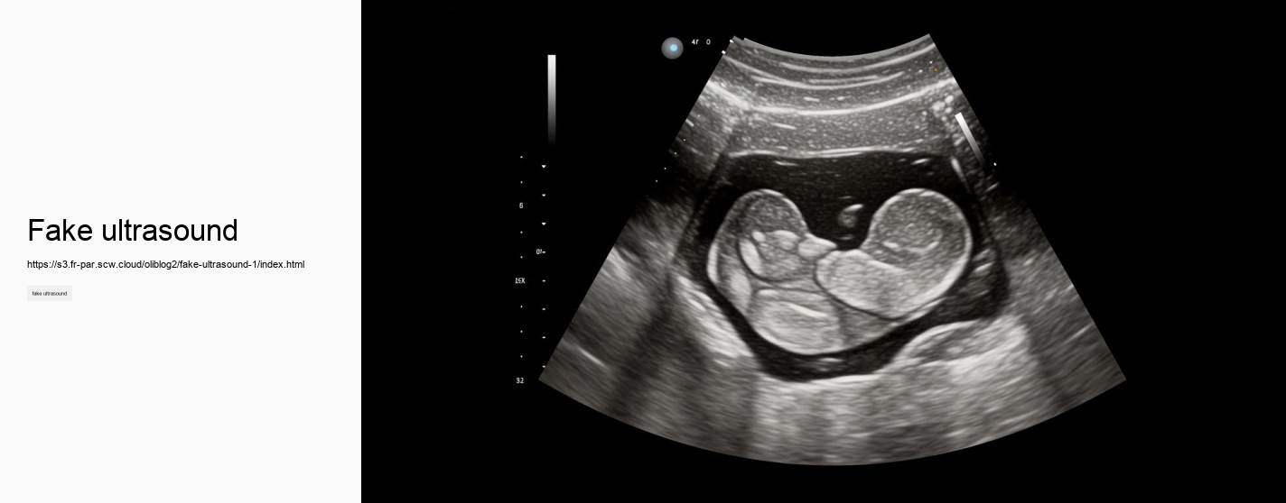 fake ultrasound
