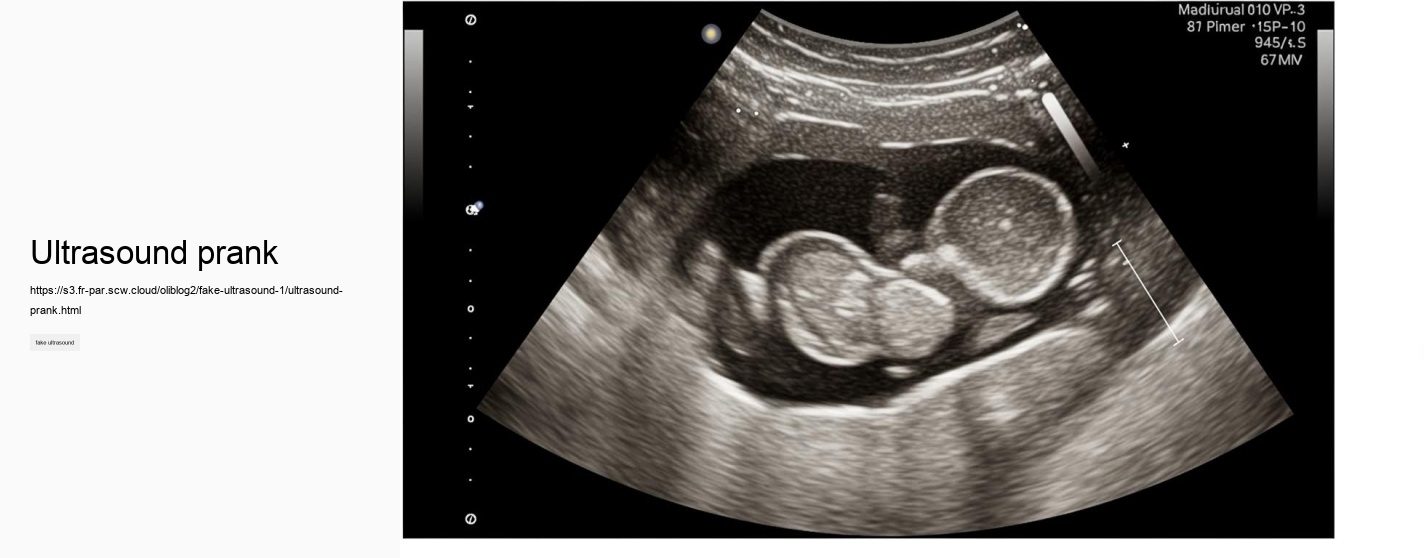 ultrasound prank