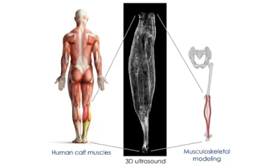 Muscle-tendon unit length measurement using 3D ultrasound in passive condition: OpenSim validation and development of personalized models