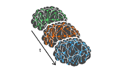 Temporal Brain Networks