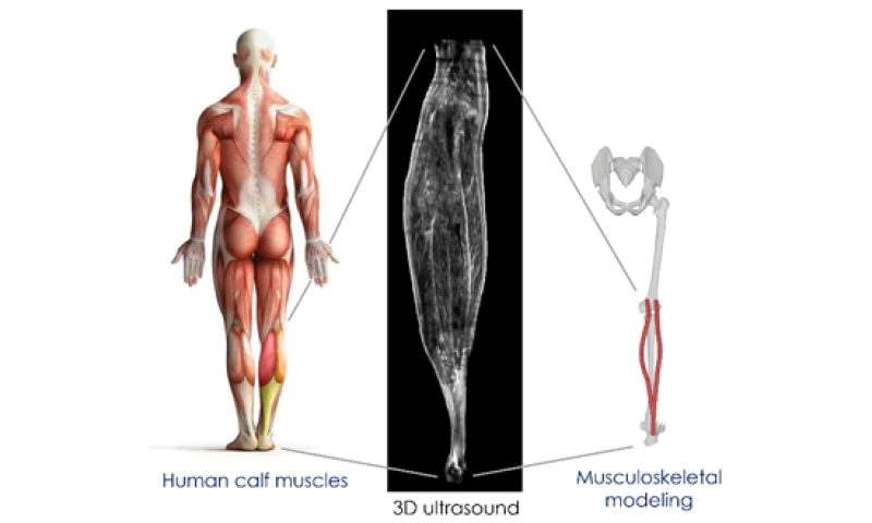 Mesure de la longueur de l'unité muscle-tendon par échographie 3D en condition passive : Validation d'OpenSim et développement de modèles personnalisés