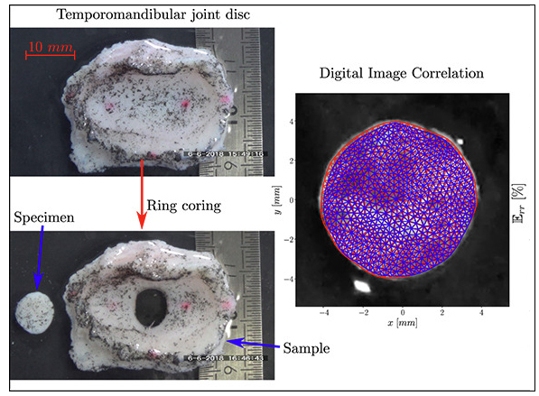 Dataset on experimental study of eigenstrains in temporomandibular joint discs using digital image analysis